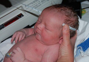 Основные причины возникновения гематомы на голове у новорожденного: виды патологии и способы её лечения