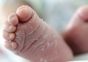 Почему у новорожденного шелушится кожа на теле: внешние и внутренние факторы, провоцирующие проблему и способы борьбы с неприятностью