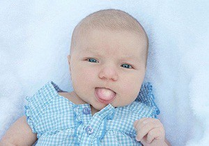 молочница во рту у ребенка фото