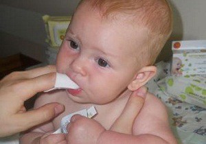 молочница у новорожденного во рту как лечить