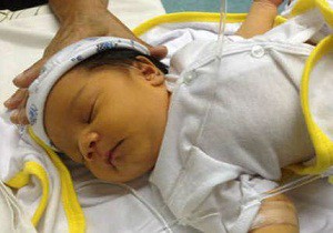 билирубин у новорожденных повышен причины