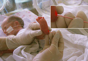 норма билирубина у новорожденных в 1 месяц