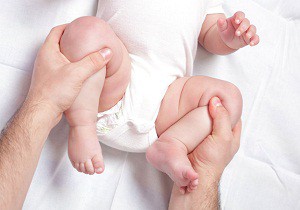 дисплазия тазобедренных суставов у младенцев