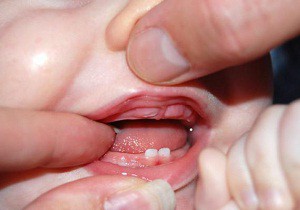 сколько держится температура при прорезывании зубов