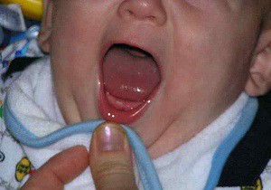 зубы у детей порядок прорезывания