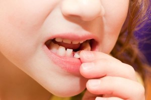 выпадение молочных зубов