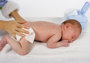 опрелость у новорожденного фото