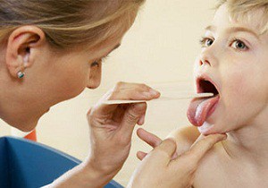 хронический тонзиллит у ребенка лечение