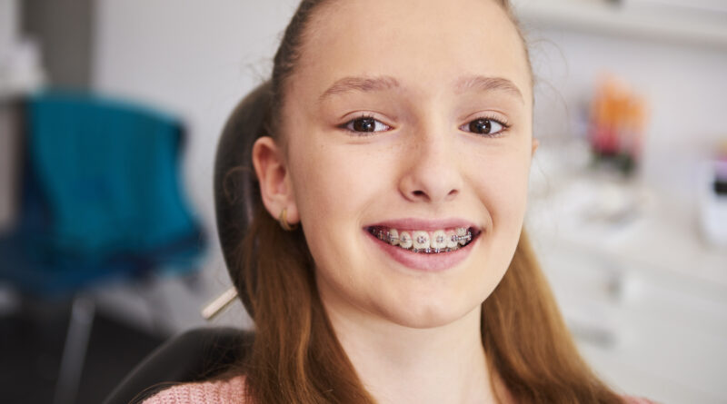 Уход за брекетами под ключ: как сохранить здоровье зубов и десен